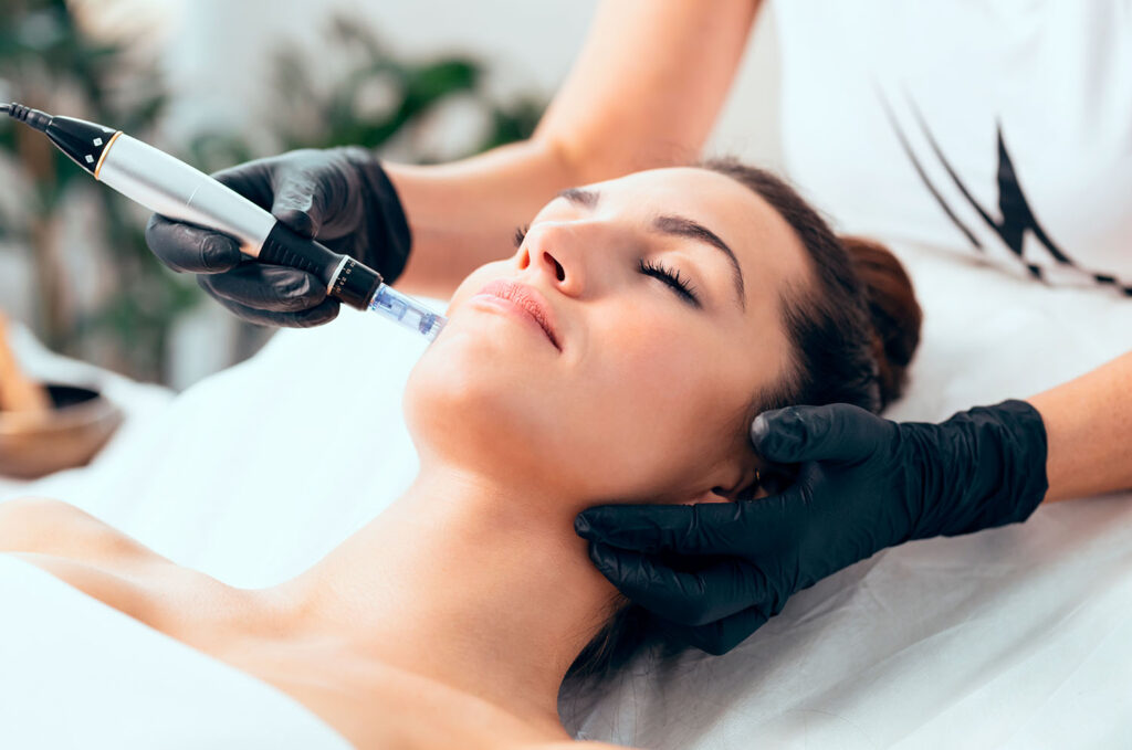 Vampirlifting-Behandlung für eine bessere Hautqualität und gegen Faltenbildung